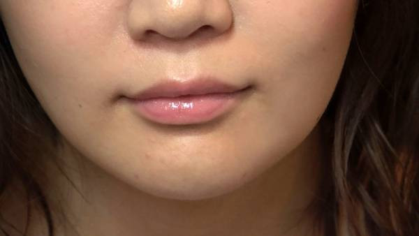 KAGP-233 이미지 #12