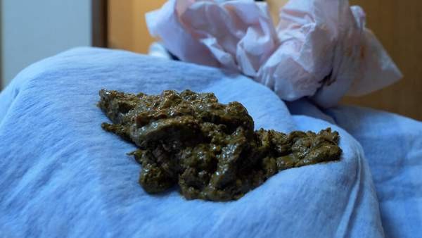 KBMS-205 이미지 #14